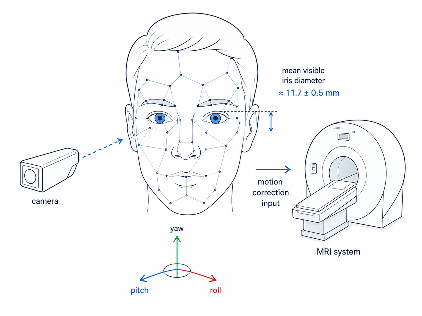 Camera-based facial landmark tracking feeding pose estimates to an MRI motion-correction system